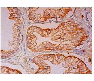 STAP-2 Antibody (E-4) - Immunohistochemistry - Image 302564 