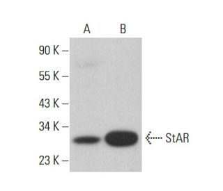 StAR Antibody (D-2) - Western Blotting - Image 385291Each CRISPR/Cas9 Knockout (KO) Plasmid product consists of a pool of 3 plasmids designed to ensure identification and cleavage of a specific gene for maximum knockout efficiency. Each plasmid encodes a unique 20 nt sequence derived from the GeCKO (v2) library.