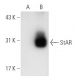 StAR (D-2): sc-166821. Western blot analysis of StAR expression in...