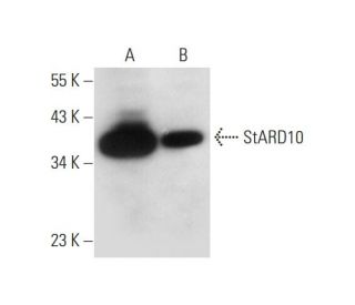 StARD10 Antibody (F-10) - Western Blotting - Image 326520 