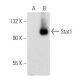 Stat1 Antibody (B-9) - Western Blotting - Image 135457