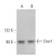 Stat1 Antibody (B-9) - Western Blotting - Image 352732 