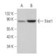 Stat1 Antibody (B-9) - Western Blotting - Image 380840 