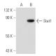 Stat1 Antibody (SM2) - Western Blotting - Image 43573 