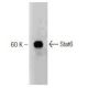 Stat6 Antibody (23) - Western Blotting - Image 127532