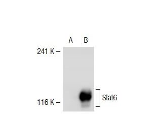 Stat6 Antibody (8C12) - Western Blotting - Image 39138