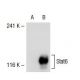 Stat6 Antibody (8C12) - Western Blotting - Image 39138