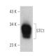 STC1 Antibody (1A3) - Western Blotting - Image 366642