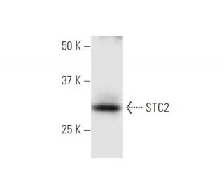 STC2 Antibody (2B11) - Western Blotting - Image 347592 