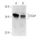 STEAP Antibody (H-6) - Western Blotting - Image 358397 