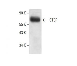 STEP Antibody (23E5) - Western Blotting - Image 11777