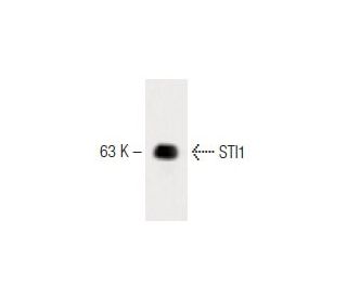 STI1 Antibody (28) - Western Blotting - Image 60455 