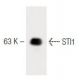 STI1 Antibody (28) - Western Blotting - Image 60455 