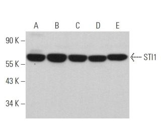 STI1 Antibody (D-6) - Western Blotting - Image 360652 