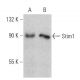 Stim1 Antibody (D-2) - Western Blotting - Image 359931