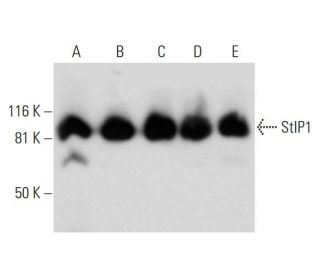 StIP1 Antibody (C-5) - Western Blotting - Image 295932