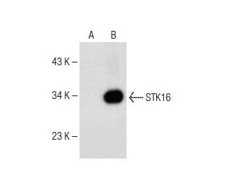 STK16 Antibody (B-10) - Western Blotting - Image 150047