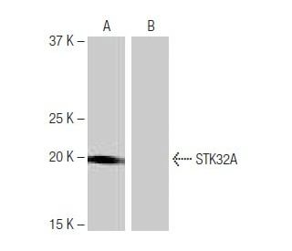 STK32A Antibody (5H10) - Western Blotting - Image 65064