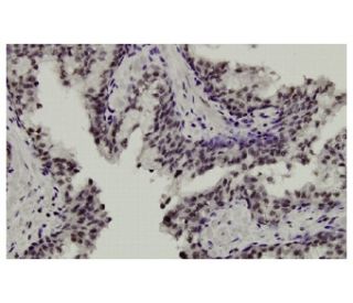 STK32C Antibody (18-56) - Immunohistochemistry - Image 36022 