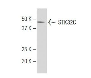 STK32C Antibody (18-56) - Western Blotting - Image 33812