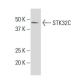 STK32C Antibody (18-56) - Western Blotting - Image 33812
