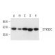 STK32C Antibody (C-6) - Western Blotting - Image 403832 