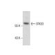 STK33 Antibody (G-11) - Western Blotting - Image 285859