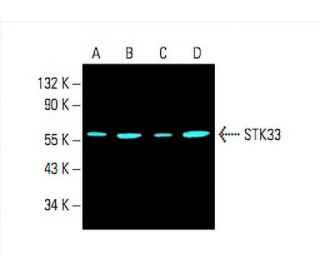 STK33 Antibody (G-11) - Western Blotting - Image 393998 