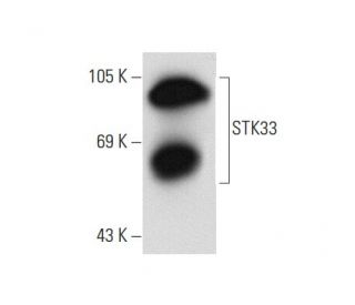 STK33 Antibody (YZ-16) - Western Blotting - Image 62275 