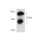 STK33 Antibody (YZ-16) - Western Blotting - Image 62275 