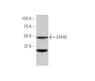 STK40 Antibody (LN-87) - Western Blotting - Image 53976