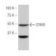STK40 Antibody (LN-87) - Western Blotting - Image 53976