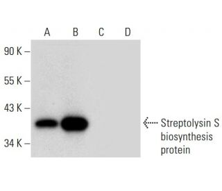 Streptolysin S biosynthesis protein Antibody (G-11) - Western Blotting - Image 306578