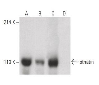 striatin Antibody (6) - Western Blotting - Image 399634 
