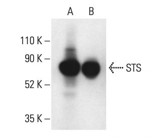 Steroid sulfatase/STS Antibody (A-6) - Western Blotting - Image 404069