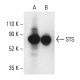 Steroid sulfatase/STS Antibody (A-6) - Western Blotting - Image 404069