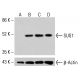 SUG1 抗体 (H-7):sc-390631。通过蛋白质印迹分析未处理的 K-562 (A)、经化学处理的 K-562 (B)、HCT-116 (C) 和 HeLa (D)细胞裂解物中的 SUG1 表达。β-肌动蛋白(C4):sc-47778 用作加载对照。使用的检测试剂:m-IgG Fc BP-HRP:sc-525409。  SUG1 Antibody (H-7) - Western Blotting - Image 415110