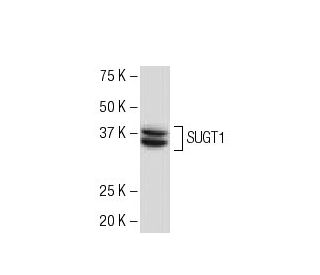 SUGT1 Antibody (YQ-R3) - Western Blotting - Image 33474 