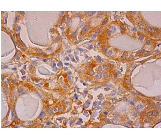 Sulfiredoxin Antibody (B-4) - Immunohistochemistry - Image 286415 