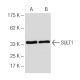 SULT1 Antibody (3F10) - Western Blotting - Image 62877