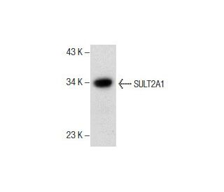 SULT2A1 Antibody (F-10) - Western Blotting - Image 157533 
