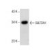 SULT2A1 Antibody (F-10) - Western Blotting - Image 157533 