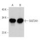 SULT2A1 Antibody (H-6) - Western Blotting - Image 364840 