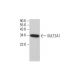 SULT2A1 Antibody (H-6) - Western Blotting - Image 377058 
