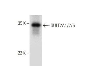 SULT2A1/2/5 Antibody (B-2) - Western Blotting - Image 312018Each CRISPR/Cas9 Knockout (KO) Plasmid product consists of a pool of 3 plasmids designed to ensure identification and cleavage of a specific gene for maximum knockout efficiency. Each plasmid encodes a unique 20 nt sequence derived from the GeCKO (v2) library.