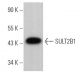 SULT2B1 Antibody (D-4) - Western Blotting - Image 364372 