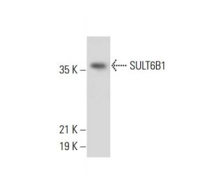 SULT6B1 Antibody (B-4) - Western Blotting - Image 308364