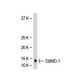 SUMO-1 Antibody (66AT1273.94) - Western Blotting - Image 37862
