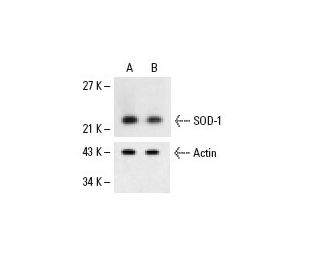 Superoxide Dismutase 1/SOD1 Antibody (G-11) - Western Blotting - Image 6771