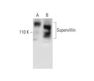 Supervillin Antibody (A-12) - Western Blotting - Image 294387 